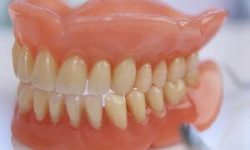 Ολική οδοντοστοιχία